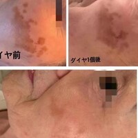 画像260
