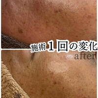 画像422