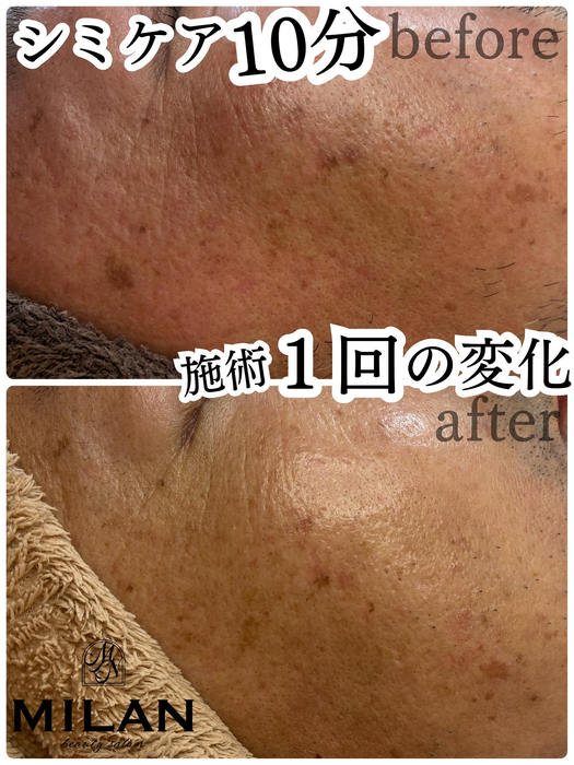 画像422