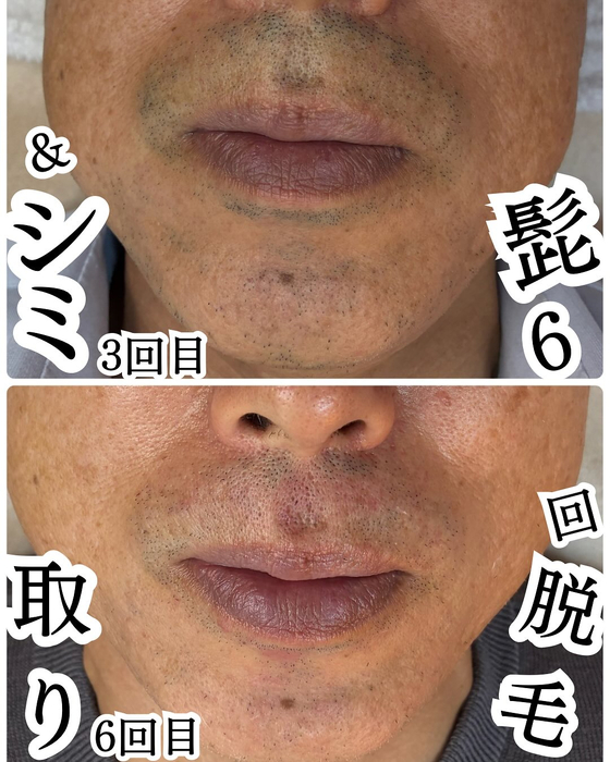 画像457