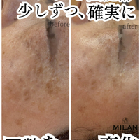 画像501