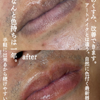 画像537