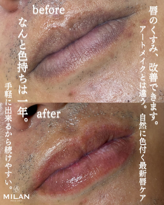 画像537